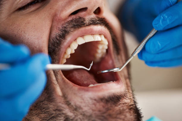 Best Dental Fillings (Composite and Amalgam)  in Frontenac, MO